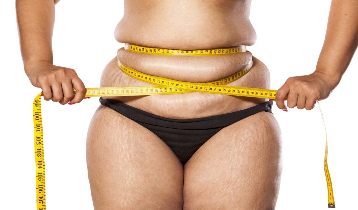 Exceso de peso y pérdida de peso usando keto probiotix